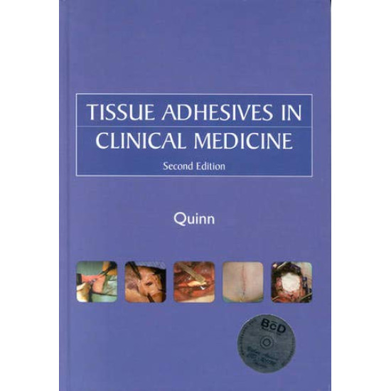 Tissue Adhesives in Clinical Medicine (BC DECKER) 