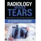 Radiology Without Tears