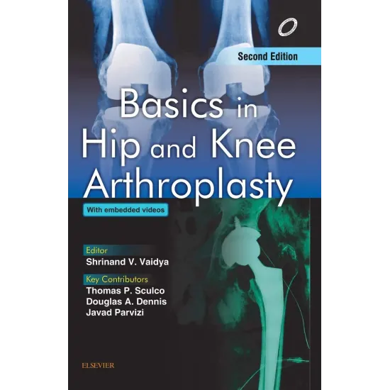 Basics in Hip and Knee Arthroplasty - 2E