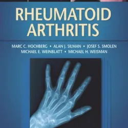 Rheumatoid Arthritis