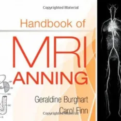 Handbook of MRI Scanning - 1E