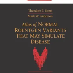 Atlas of Normal Roentgen Variants 9/e