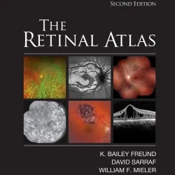 The Retinal Atlas - 2E