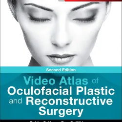 Video Atlas of Oculofacial Plastic and Reconstructive Surgery - 2E