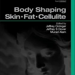 Body Shaping: Skin Fat Cellulite: Procedures in Cosmetic Dermatology Series