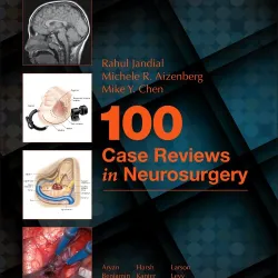 100 Case Reviews in Neurosurgery - 1E