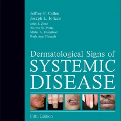 Dermatological Signs of Systemic Disease - 5E