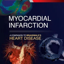 Myocardial Infarction: A Companion to Braunwald's Heart Disease