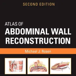 Atlas of Abdominal Wall Reconstruction -2E