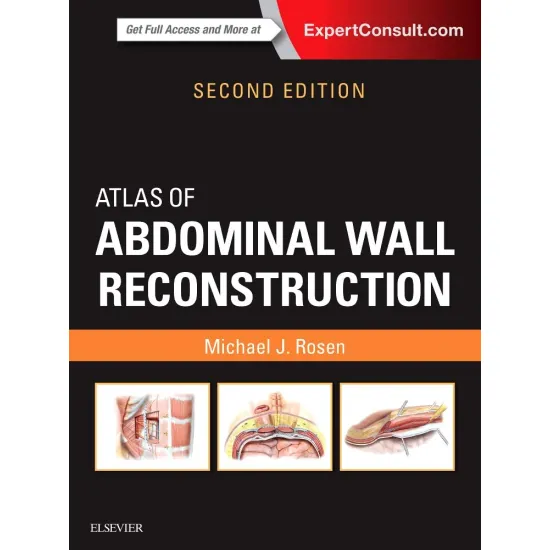 Atlas of Abdominal Wall Reconstruction -2E