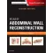 Atlas of Abdominal Wall Reconstruction -2E