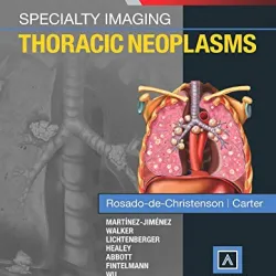 Specialty Imaging: Thoracic Neoplasms