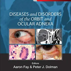 Diseases and Disorders of the Orbit and Ocular Adnexa: Expert Consult - Online and Print - 1E