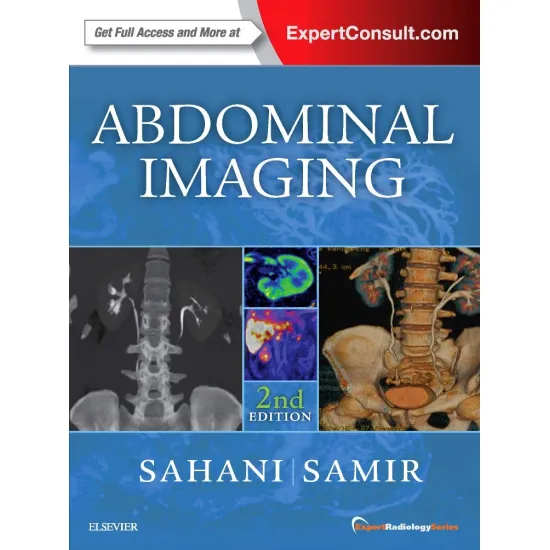 Abdominal Imaging: Expert Radiology Series - 2E