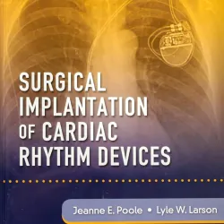 Surgical Implantation of Cardiac Rhythm Devices - 1E