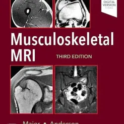 Musculoskeletal MRI - 3E