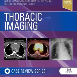 Thoracic Imaging: Case Review - 3E