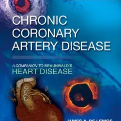 Chronic Coronary Artery Disease: A Companion to Braunwald's Heart Disease