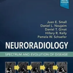 Neuroradiology: Spectrum and Evolution of Disease - 1E