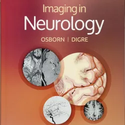 Imaging in Neurology