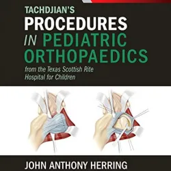 Tachdjian's Procedures in Pediatric Orthopaedics: From the Texas Scottish Rite Hospital for Children - 1E