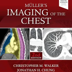 Muller's Imaging of the Chest -2E