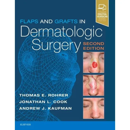 Flaps and Grafts in Dermatologic Surgery - 2E