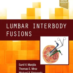 Lumbar Interbody Fusions -1E