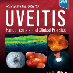 Whitcup and Nussenblatt's Uveitis-5E