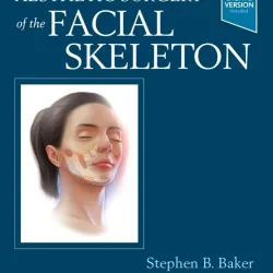 Baker - Aesthetic Surgery of the Facial Skeleton-1E