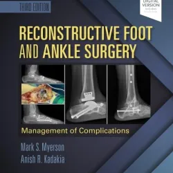 Reconstructive Foot and Ankle Surgery: Management of Complications : Expert Consult - Online, Print, and DVD - 3E