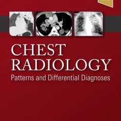 Chest Radiology: Patterns and Differential Diagnoses -7E