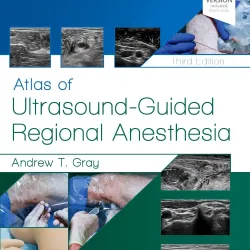 Atlas of Ultrasound-Guided Regional Anesthesia: Expert Consult -3E