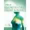 Atlas of Reconstructive Breast Surgery - 1E