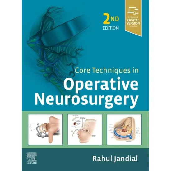 Core Techniques in Operative Neurosurgery: Expert Consult - Online and Print - 2E