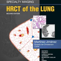 Specialty Imaging: HRCT of the Lung - 2E