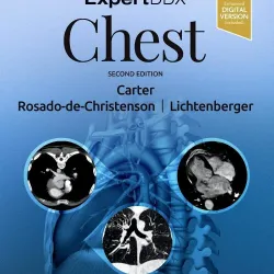 ExpertDDx: Chest-2E