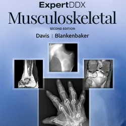 ExpertDDx: Musculoskeletal - 2E