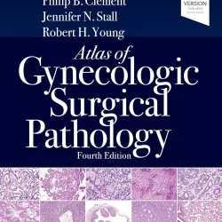 Atlas of Gynecologic Surgical Pathology -4E