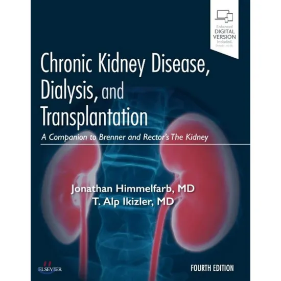 Chronic Kidney Disease, Dialysis, and Transplantation: A Companion to Brenner and Rector's The Kidney - 4E