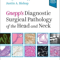 Gnepp's Diagnostic Surgical Pathology of the Head and Neck-3E