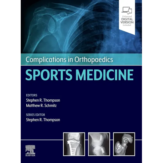 Complications in Orthopaedics: Sports Medicine -1E