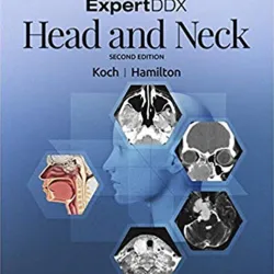 ExpertDDX: Head and Neck-2E