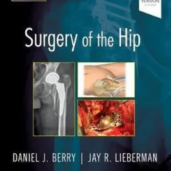 Surgery of the Hip: Expert Consult - Online and Print - 2E