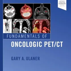 Fundamentals of PET/CT -1E