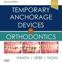 Temporary Anchorage Devices in Orthodontics - 2E