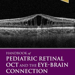 Handbook of Pediatric Retinal OCT and the Eye-Brain Connection-1E