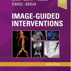 Image-Guided Interventions-3E