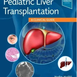 Pediatric Liver Transplantation - 1E