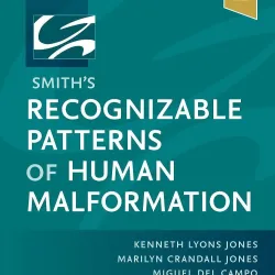 Smith's Recognizable Patterns of Human Malformation - 8E